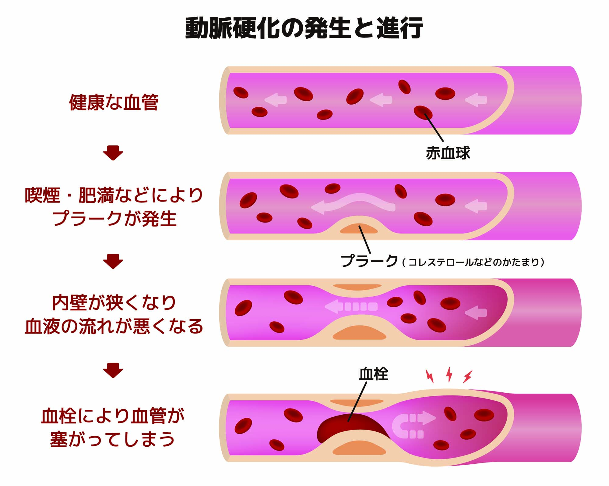 血管への効力